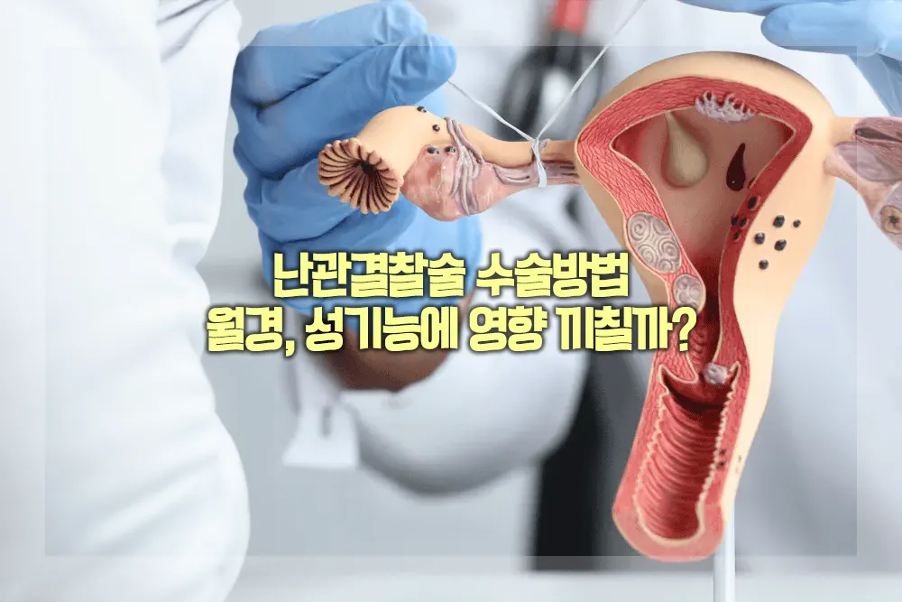 난관결찰술 수술방법