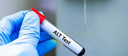 간수치 AST ALT 정상범위 혈액검사