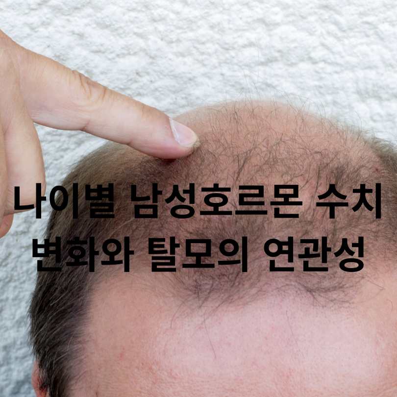 나이별 남성호르몬 수치 변화와 탈모의 연관성