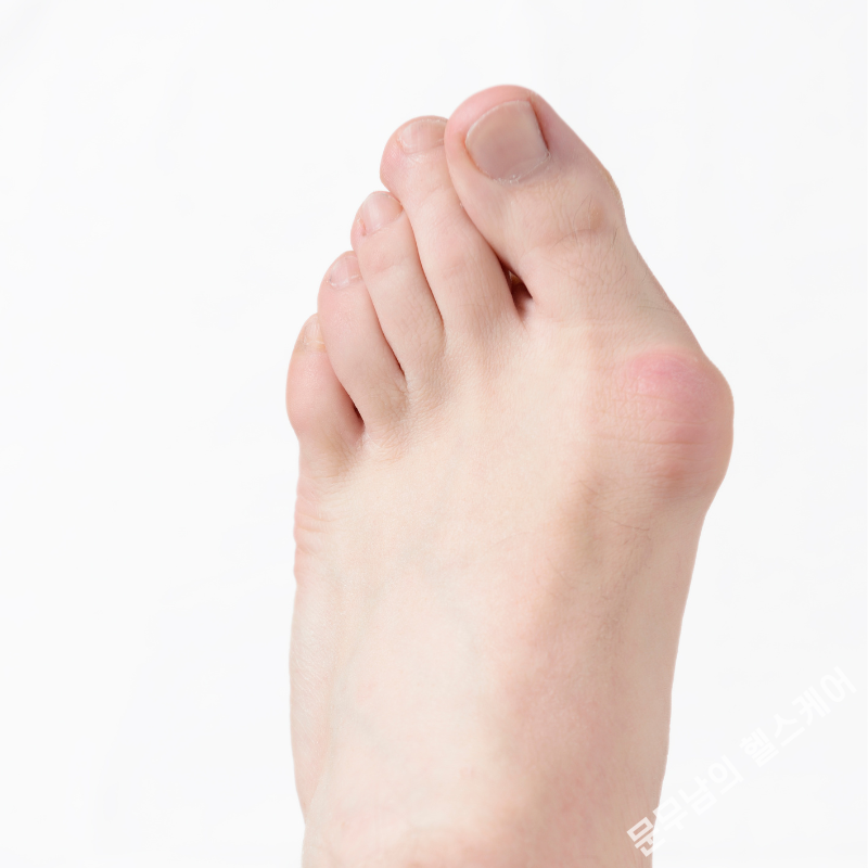 발가락 통증 원인