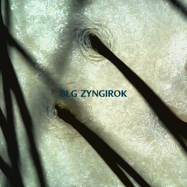 탈모 극복 프로젝트 - 정수리 두피 모습이다.