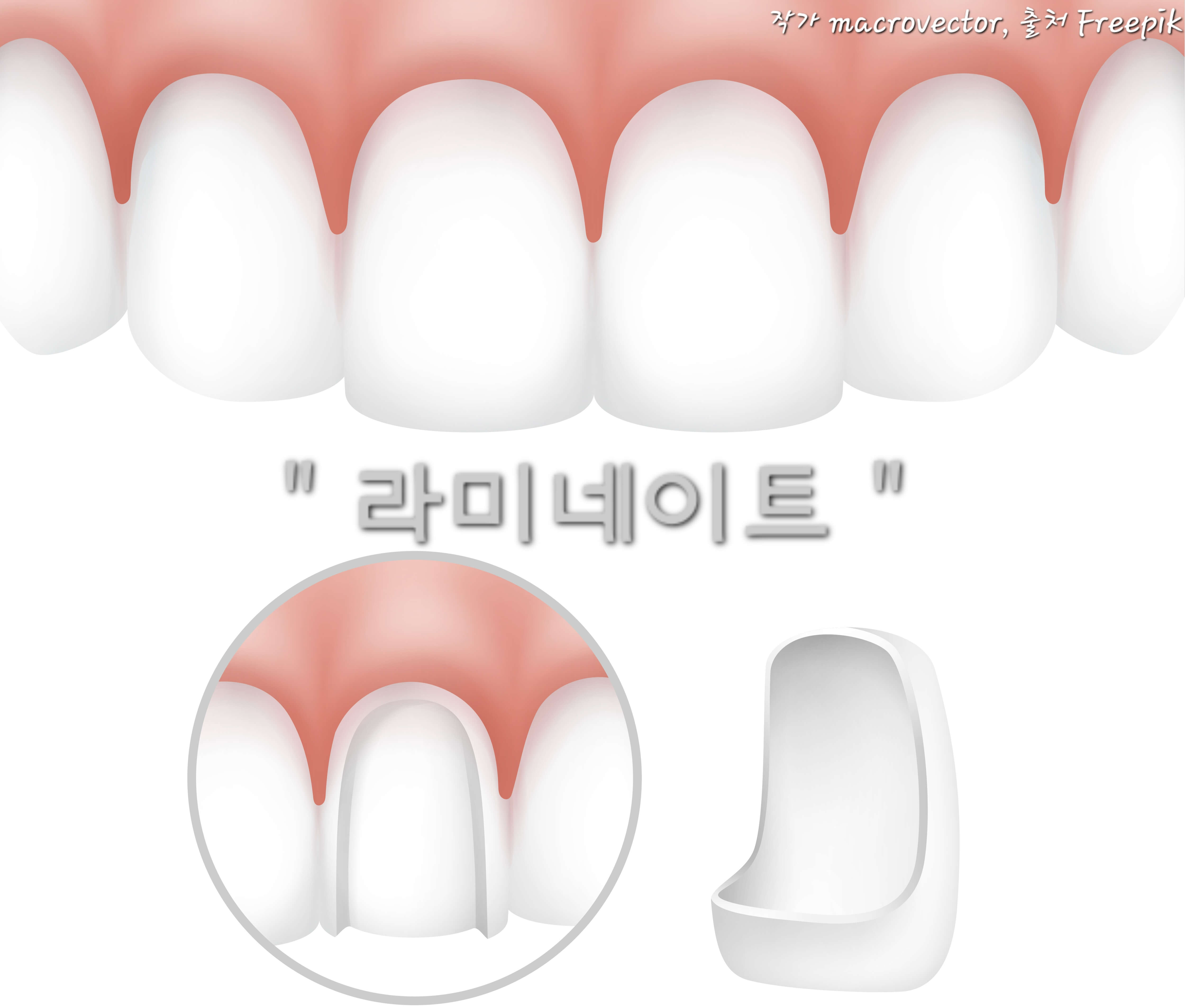 라미네이트