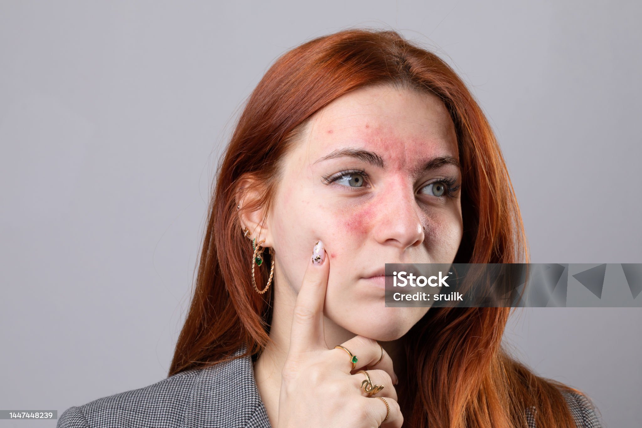 피부질환 주사 관련 사진