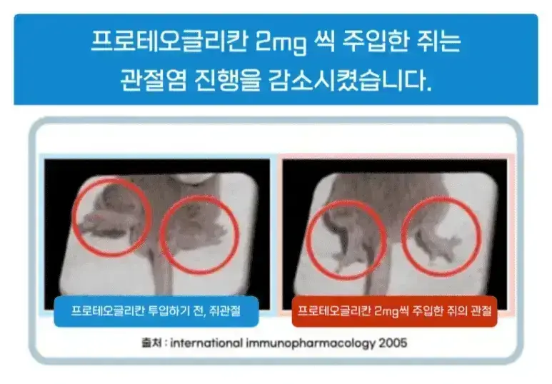 연골주사