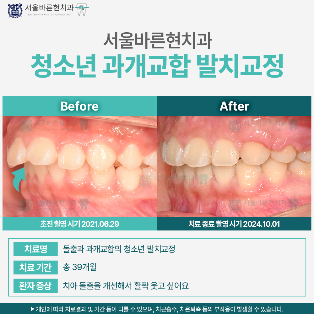 부산교정치과