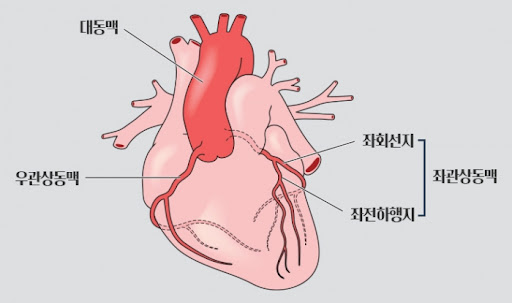 협심증 증상