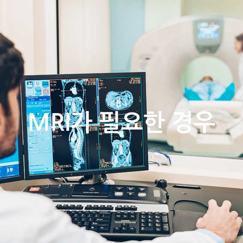 MRI와 CT의 차이점