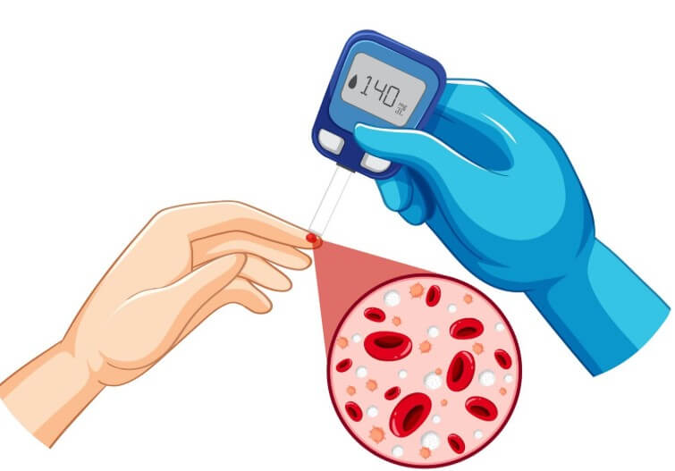 고혈당 환자의 혈액 속 성분을 분석하는 모습