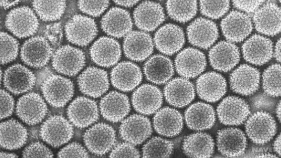 아데노바이러스 전자현미경 사진 (출처: GettyimagesKorea)