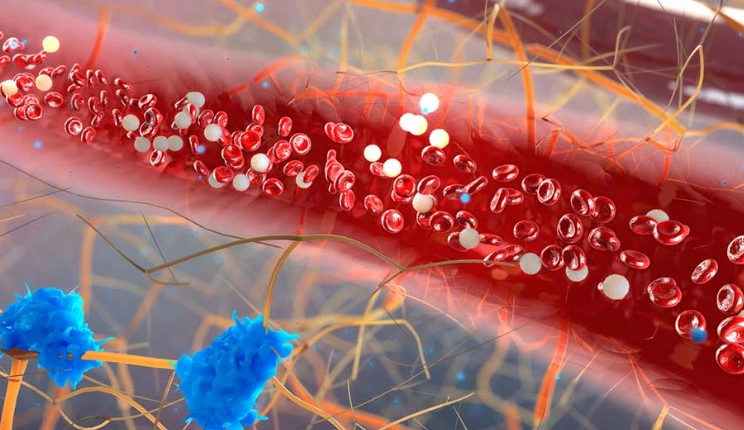 혈당 스파이크 증상