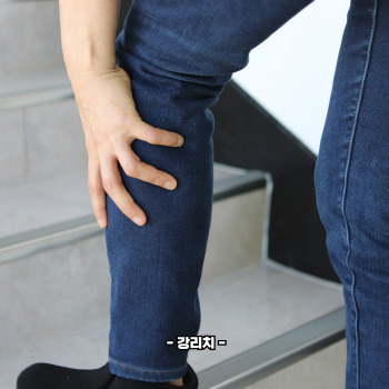 하지정맥류 원인