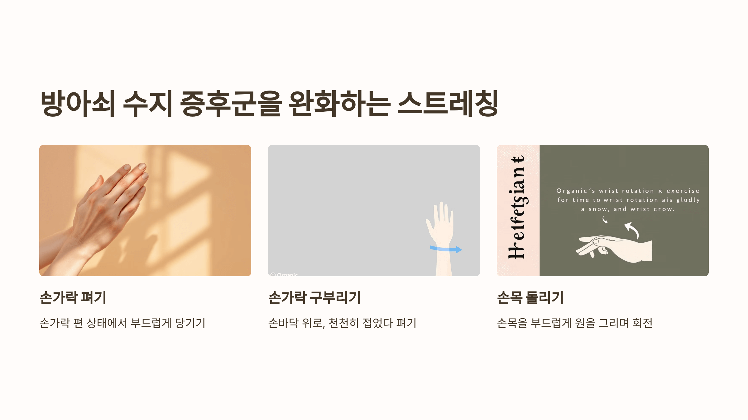 방아쇠 수지 증후군 관련된 사진입니다.