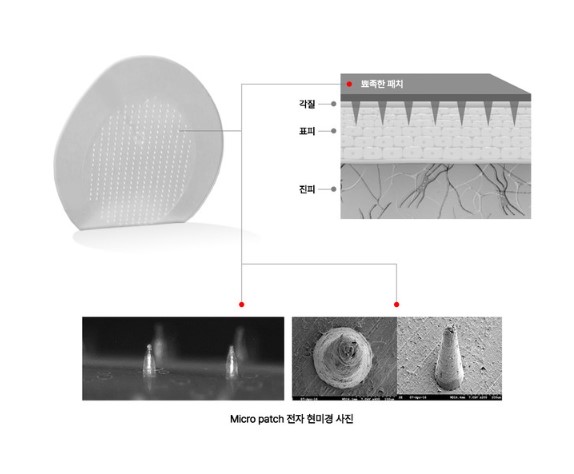 패치큐 붙이는 화이트 벨라 기미 패치