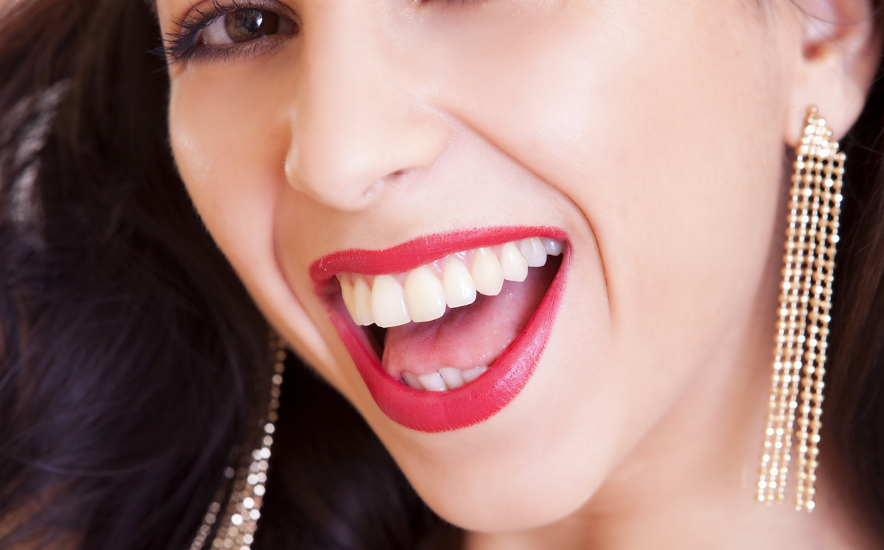 치아_임플란트 상세