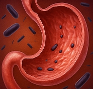 식은땀 나는 이유