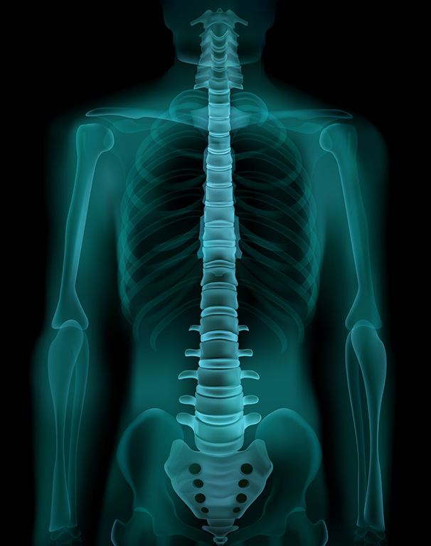 척수를 설명하기 위한 x-ray 사진