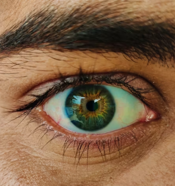 황반변성 치료법 자가진단 방법 합병증