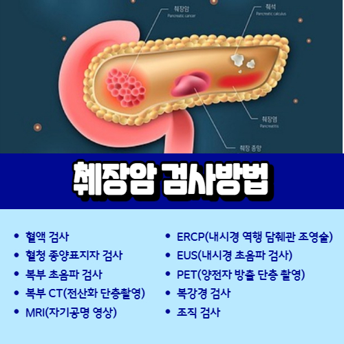 췌장암 검사방법