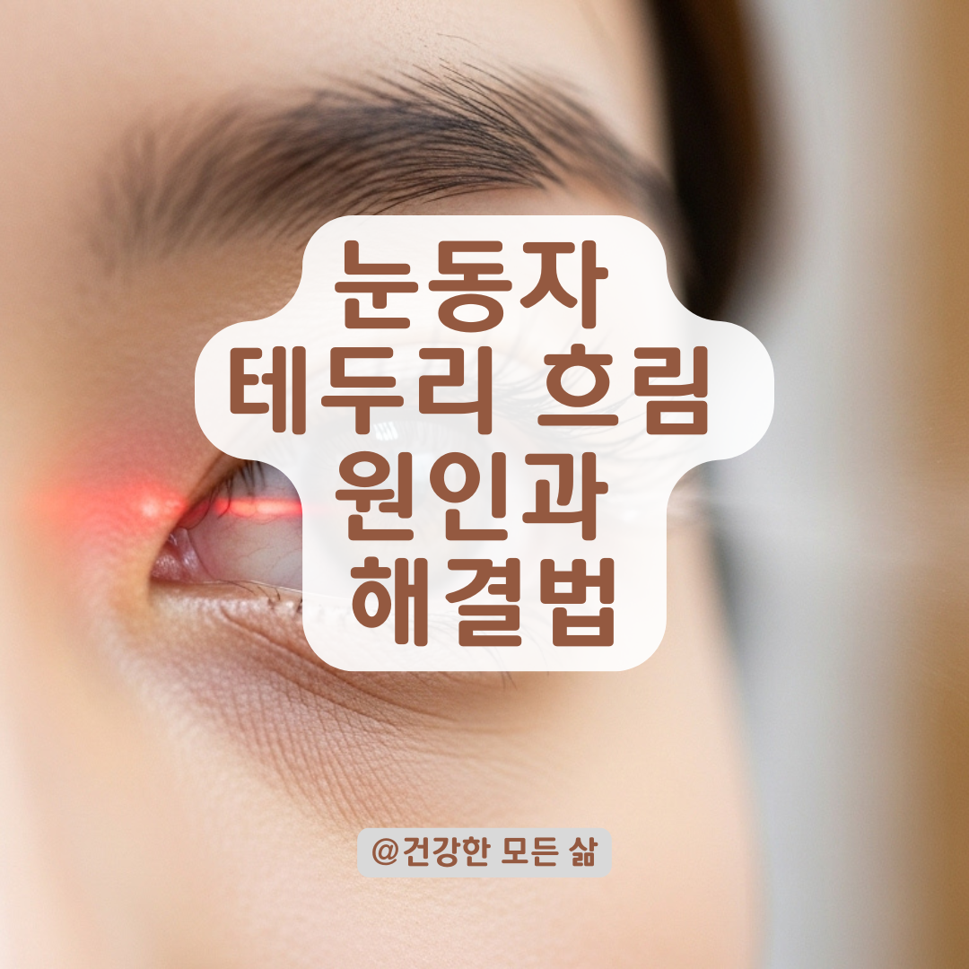 눈동자 테두리가 흐릿해졌다면? 시력 변화와 각막 이상 가능성, 대처법까지 정리.