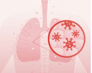 폐렴-초기-증상과-원인-5
