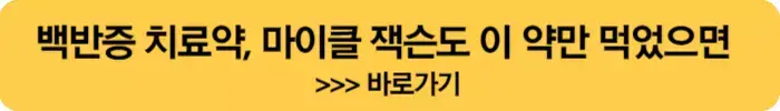 백반증-치료약-원인-증상-치료