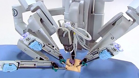 EBS 명의 다시보기 방광암 수술 혈뇨