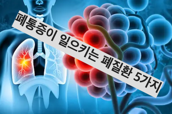 폐통증이 일으키는 폐질환 5가지