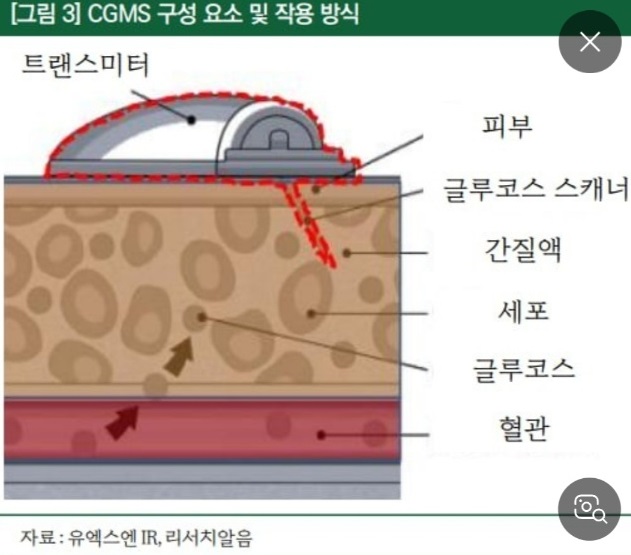 연속혈당측정기