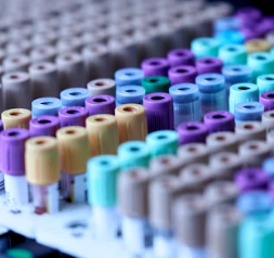 고지혈증 치료법 진단기준 예방