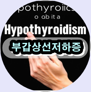 부갑상선저하증 증상,부갑상선저하증 치료법,부갑상선저하증 자연치료,부갑상선저하증 검사,부갑상선저하증 관리법,저칼슘혈증 원인,갑상선 수술 후 부갑상선저하증,PTH 보충 요법,저칼슘혈증 대처법,부갑상선호르몬 결핍