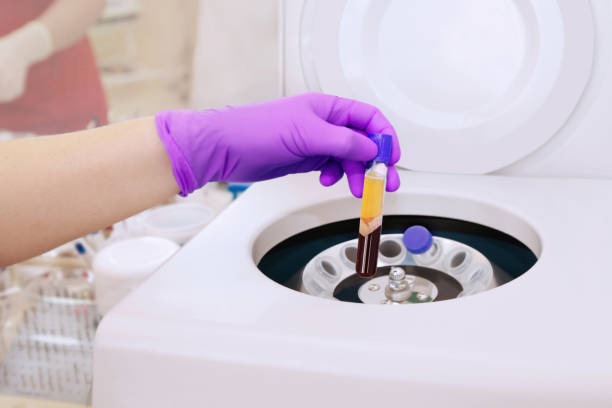 혈장교환 Plasmapheresis 치료
