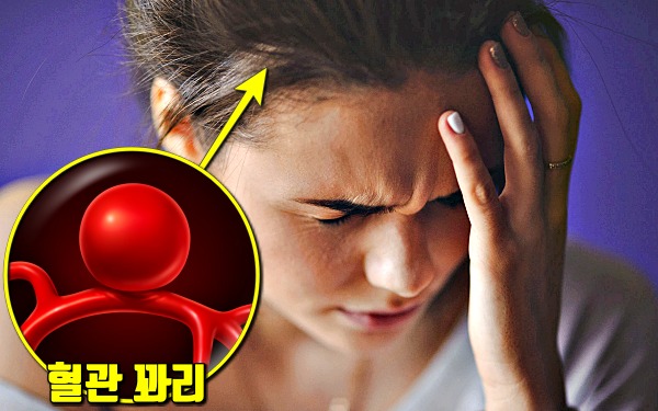 두통 뒷목 뒷골 뇌졸중 전조 증상, 뇌경색 초기증상, 뇌졸중 초기증상, 건강 팁줌 매일꿀정보