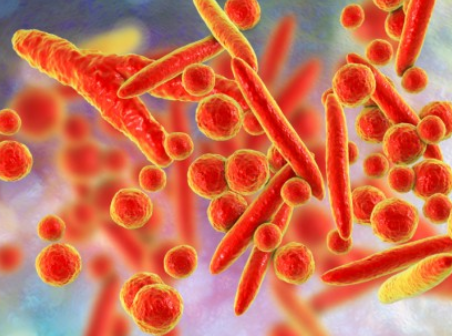 마이코플라스마-폐렴