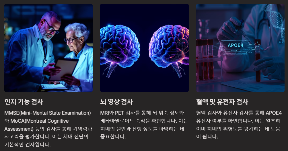 알츠하이머 치매 진단 방법