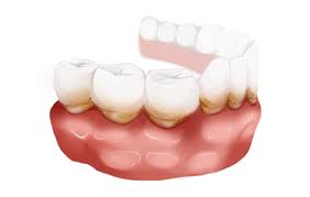 잇몸이 붓고 아플 때