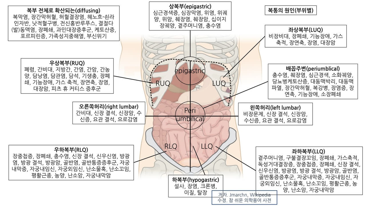 acute abdomen. 출처 Jmarchin, Wikipedia 의학용어 acute abdomen 뜻 급성복증