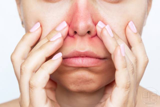 얼굴 붉은기 원인 얼굴 빨개지는 이유 얼굴홍조 원인 지루성피부염