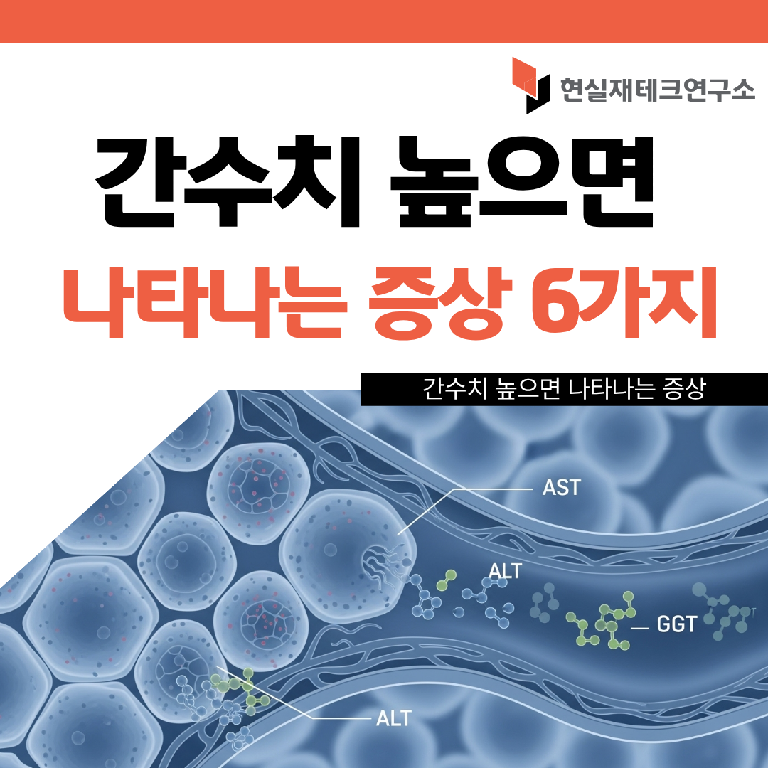 간수치 높으면 나타나는 증상