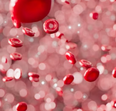 고지혈증 증상 원인 예방법 음식