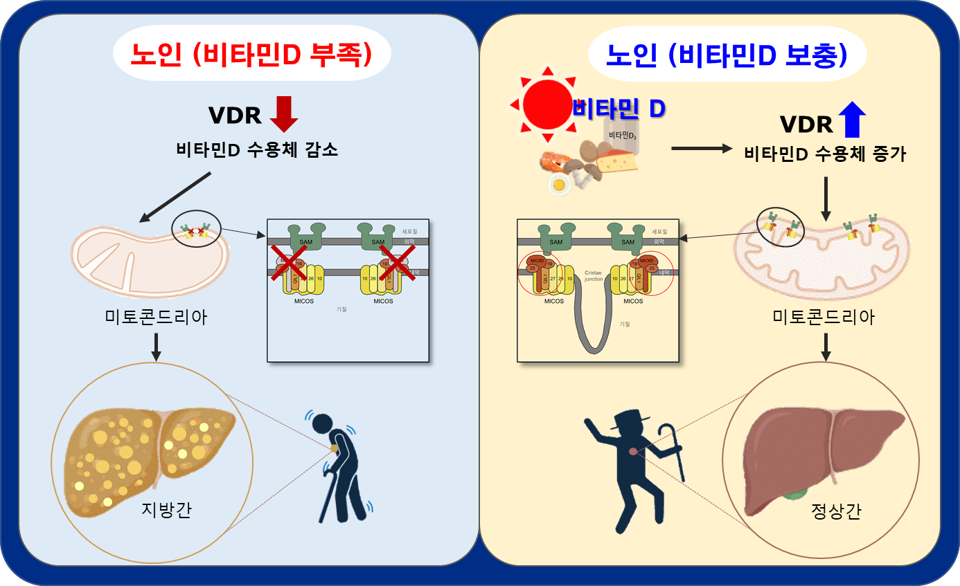 지방간 비타민 효능 부작용 결핍 부족 연구결과 질병관리청