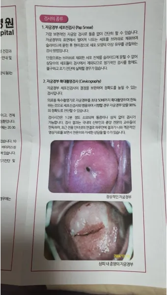 출산 후 자궁수축 기간_17