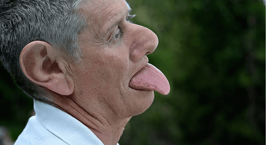 혓바닥이 갈라지는 이유 - 5