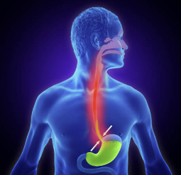 역류성식도염 증상 자연치료 방법 좋은 음식 등 총정리(2024 최신)