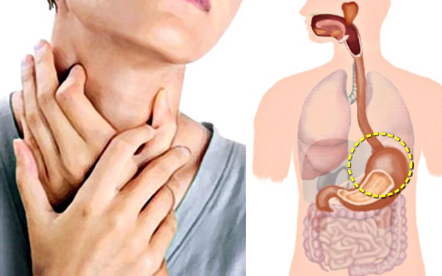 신트림 신물이 올라오는 이유 소화가 잘 안될때 나타나는 증상, 소화불량 증상, 팁줌