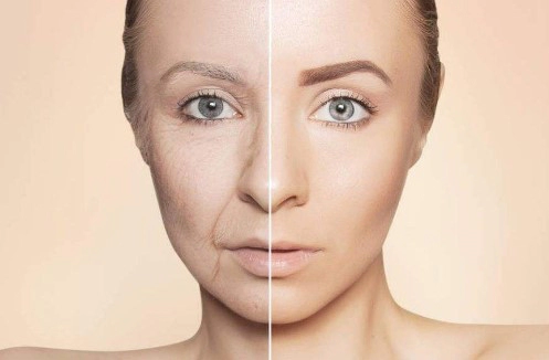 팔자주름 수술과정 및 비용