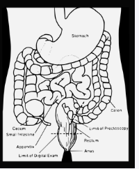 충수염 원인과 증상