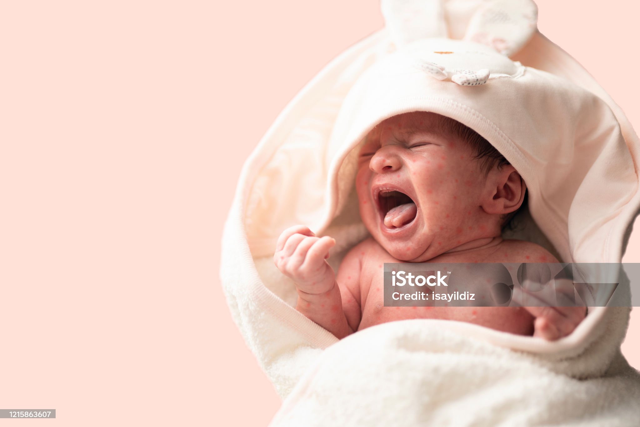 풍진-관련-사진