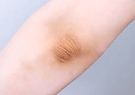 팔꿈치 착색 제거 관리 팁