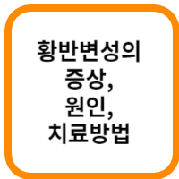 황반변성의-증상-원인-치료방법-섬네일