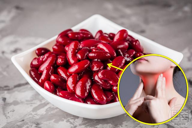 갑상선에 좋은 음식 강낭콩